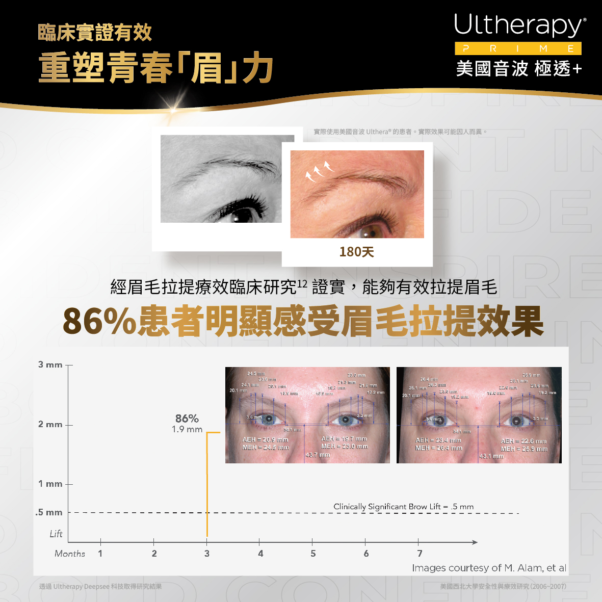 美國音波二代有通過美國 FDA 與台灣 TFDA 認證嗎？