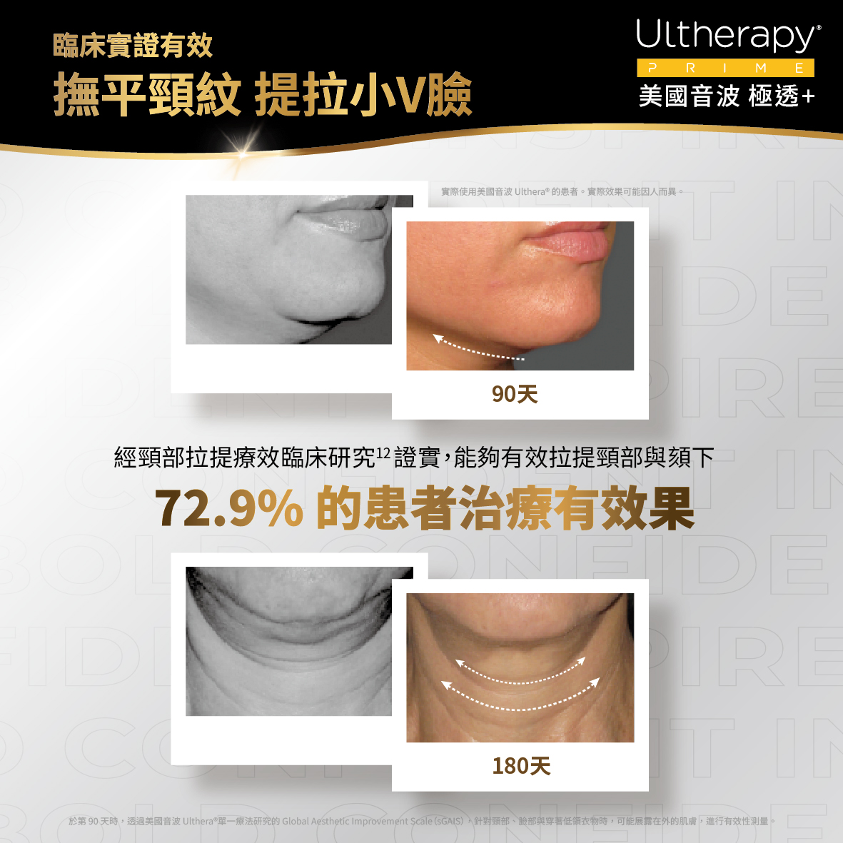 雕塑輪廓邊緣的下顎線鬆弛